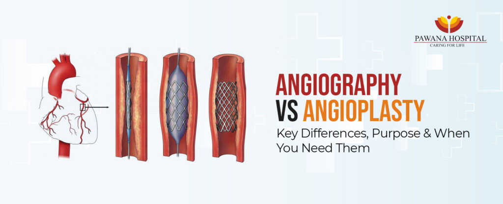 Angiography vs Angioplasty: Key Differences, Purpose & When You Need Them
