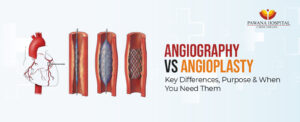 Angiography vs Angioplasty: Key Differences, Purpose & When You Need Them