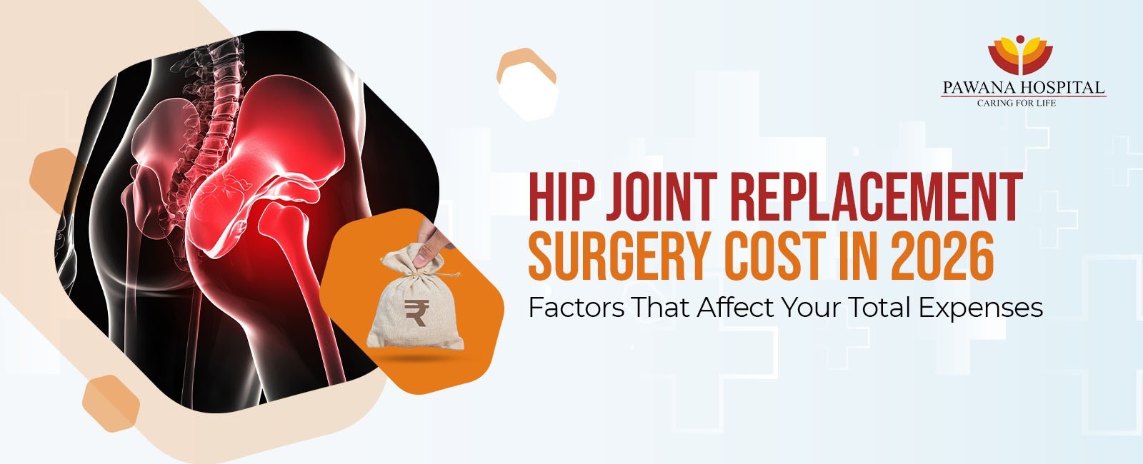 Hip Joint Replacement Cost in 2026
