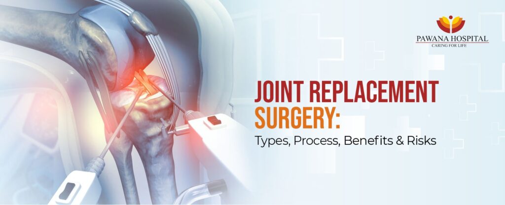 Joint Replacement Surgery