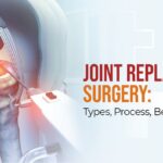 Joint Replacement Surgery