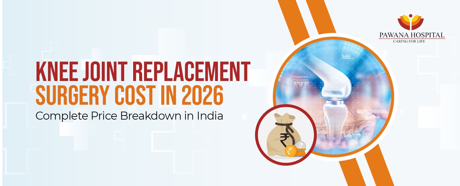 Knee Replacement Surgery Cost in India 2026