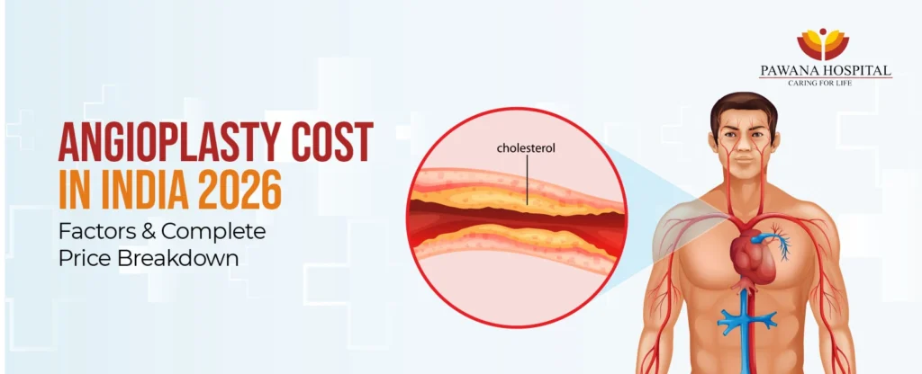 Angioplasty Cost in India 2026: Factors & Complete Price Breakdown