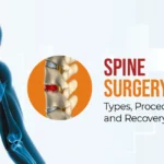 Spine Surgery