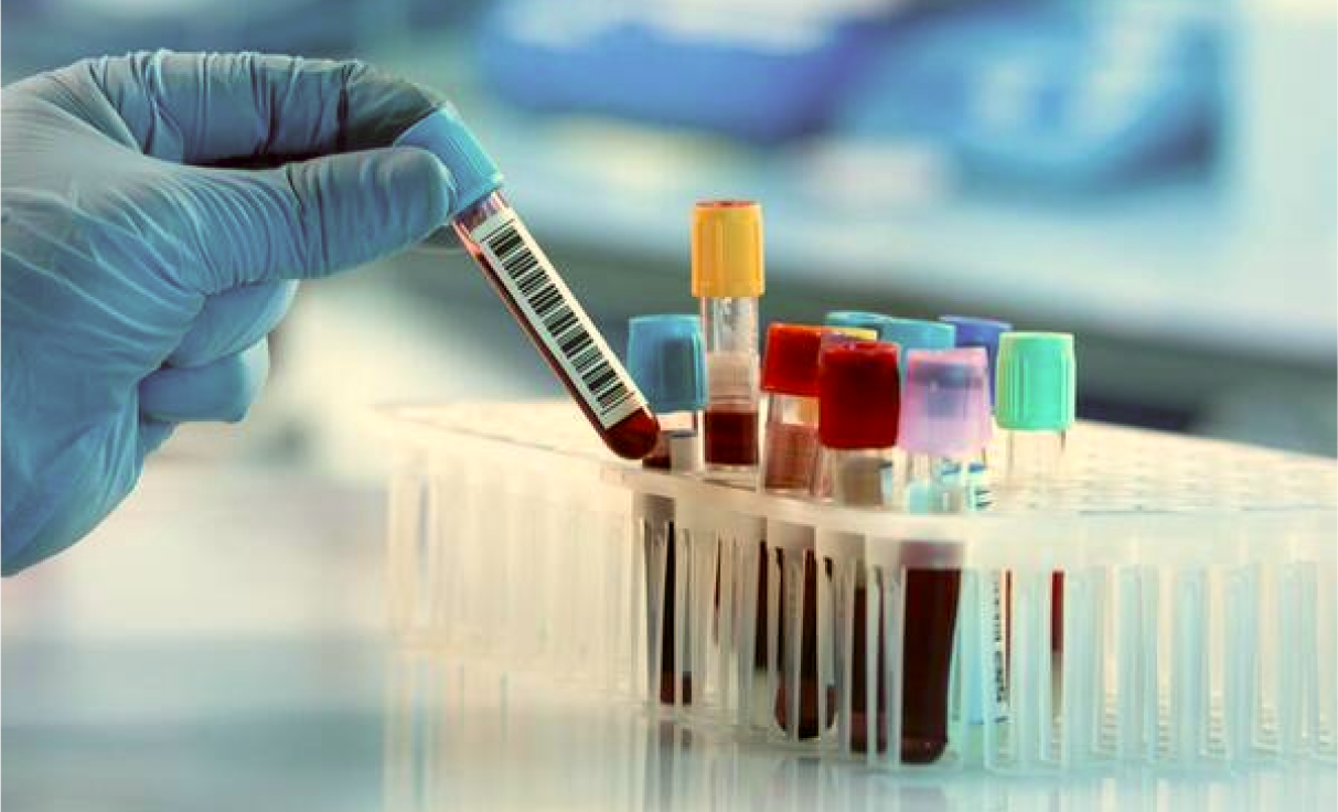 Blood Test