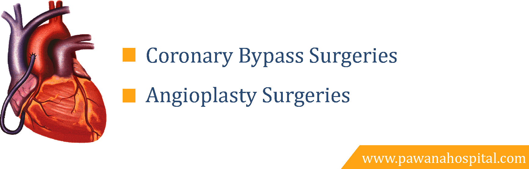 bypass surgeries in pune | Angioplasty Surgeries | pawana hospital